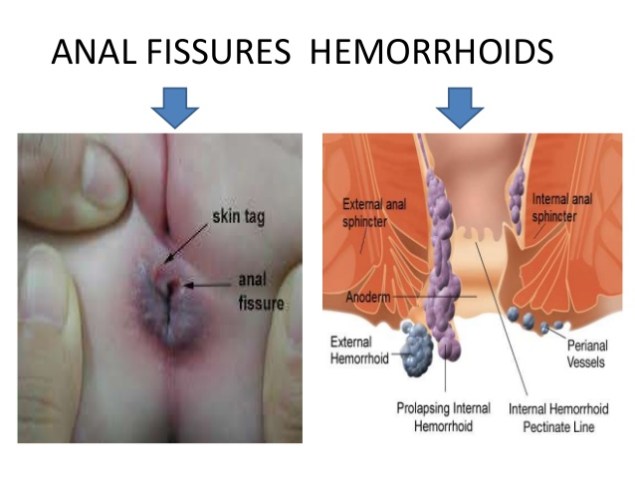 medicine-constipation-ppt-5-638